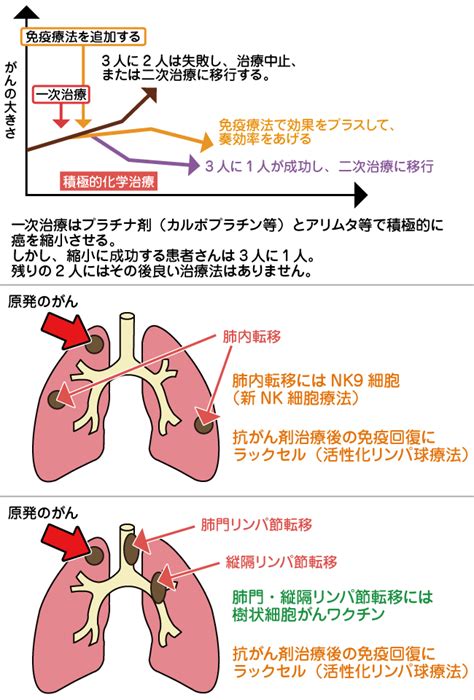 肺がんの治療・手術 新横浜かとうクリニック