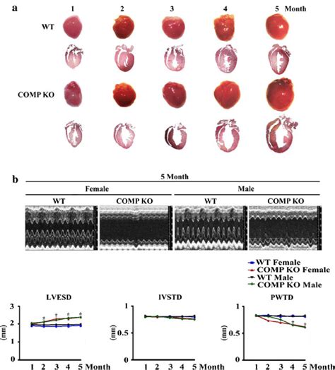 Spontaneous Dilated Cardiomyopathy DCM In COMP Mice A