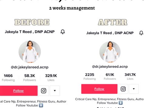 Organic Tiktok Followers To Grow And Promote Your Tiktok Account Viral Upwork