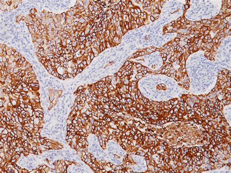Cytokeratin LMW (8/18) Antibody - Biocare Medical
