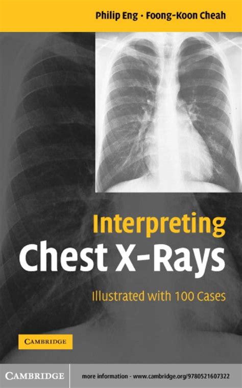 Interpreting Chest X Rays 1st Edition EBook In 2021 Medical