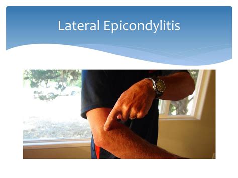 Ppt Prp For Lateral Epicondylitis Powerpoint Presentation Free