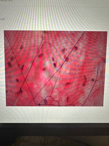 Connective Tissues Flashcards Quizlet