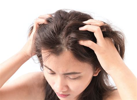 6 Reasons Why Your Scalp Is Itchy And What To Do About It Buckhead