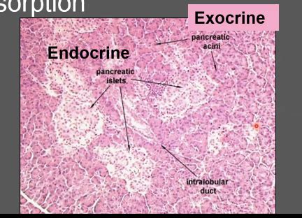 Exocrine Pancreatic Disease (Pancreatitis) Flashcards | Quizlet