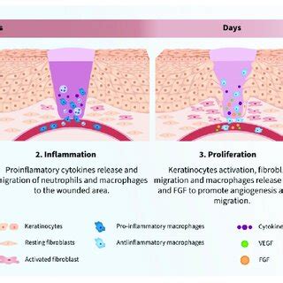 Wound healing process phases. 1. Hemostasis. Rupture of the veins ...