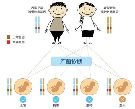 植入前基因检测技术的原理 遗传病生育网