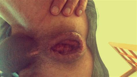 Anal Gape And Cumshot Gay Gaping Gaping Porn Feat Jardinsecret Xhamster