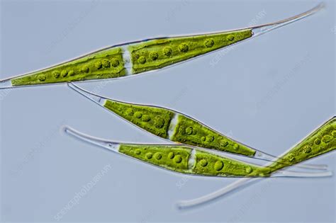 Closterium Sp Green Alga Lm Stock Image C0216067 Science Photo