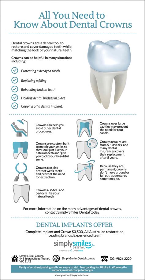 Dental Crowns All You Need To Know Simply Smiles Dental