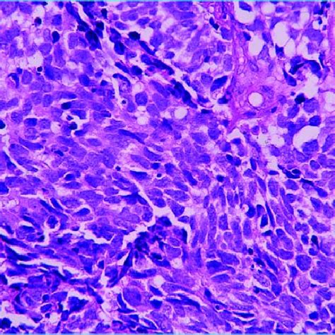 Hematoxylin And Eosin He Staining High Power View × 40 Of A