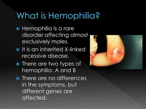 Ppt Hemophilia Powerpoint Presentation Free Download Id 2758784