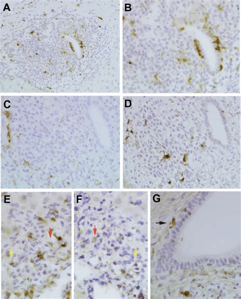 Immunohistochemistry Demonstrating The Localization Of Dcs In The Download Scientific Diagram