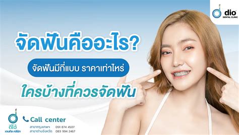 จัดฟัน คืออะไร จัดฟันมีกี่แบบ ราคาเท่าไหร่ ใครบ้างควรจัดฟัน