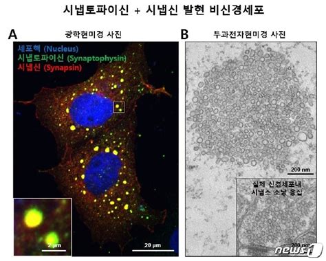 뇌속 신경전달물질 주머니 뭉쳐있는 원리 규명 머니투데이