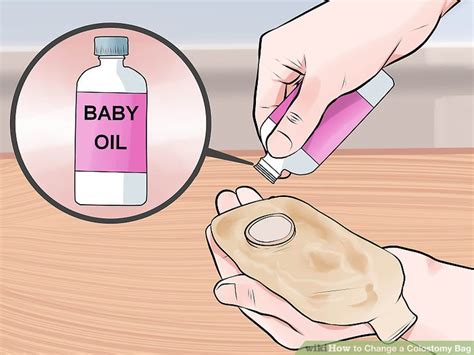 How to Change a Colostomy Bag: 12 Steps (with Pictures) - wikiHow