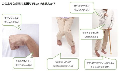 ボツリヌス療法のご案内 白澤病院