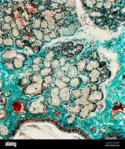 Salivary Gland Tissue Light Micrograph In Humans There Are Three Sets