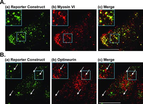 Colocalization Of Myosin VI And Optineurin With Secretory Vesicles At