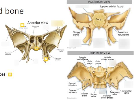 Sphenoid Bone Diagram Quizlet