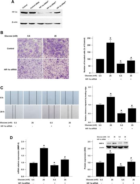 Hyperglycemia Aggravates Microenvironment Hypoxia And Promotes The