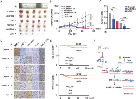 BRD4 Expression Predicts Prognosis Of Uterine Cervical Cancer A SiHa