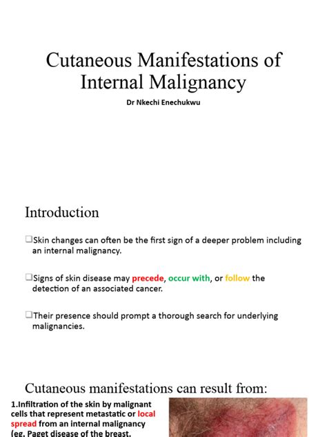 Dr Enechukwu Cutaneous Manifestations In Internal Malignancy Pdf Cancer Neoplasms