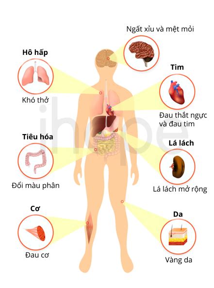 Thiếu máu rối loạn sinh hồng cầu bẩm sinh – ihope