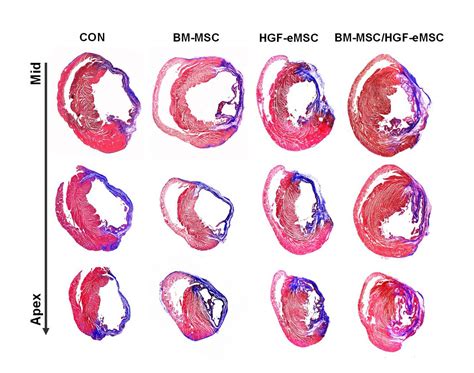 Comparison Of Cardiac Tissues [image] Eurekalert Science News Releases