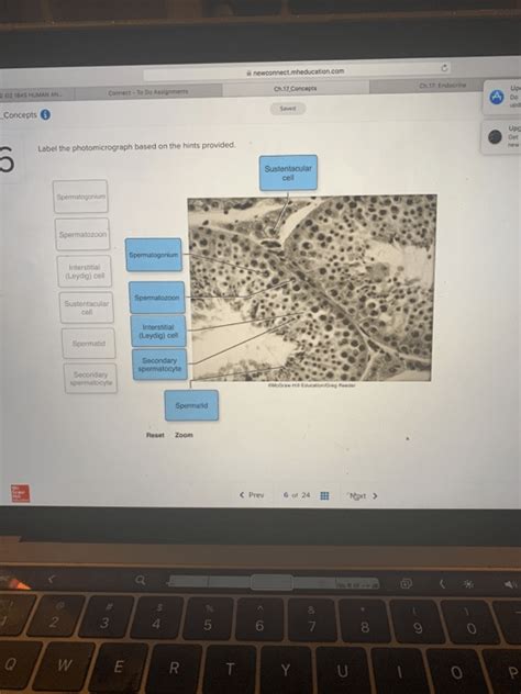 Label The Photomicrograph Based On The Hints Provided Glomerulus Of