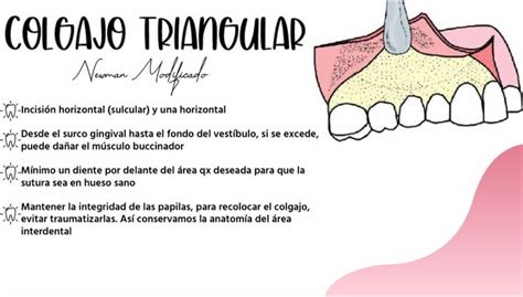 Colgajo Utilizado En Cirug A Bucal Cirugia Bucal Ilustraci N