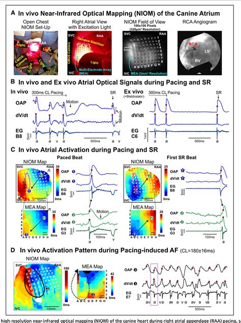 Figure I From First In Vivo Use Of High Resolution Near Infrared