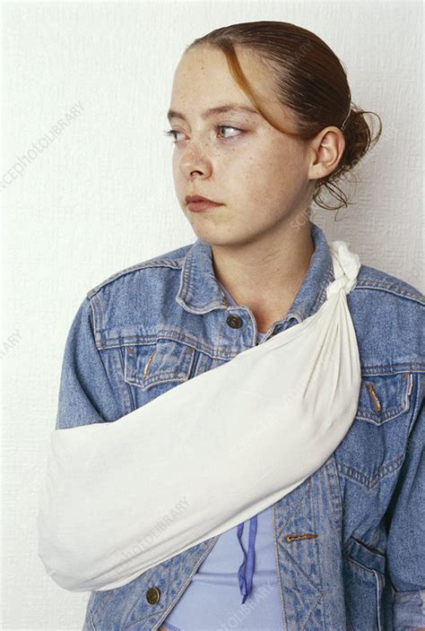 Bandaged arm - Stock Image - M526/0198 - Science Photo Library