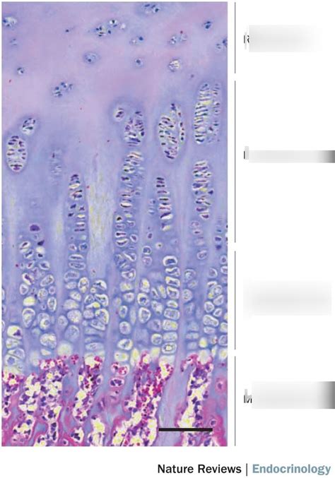 Growth Plate Diagram Diagram Quizlet