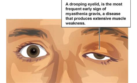 Neuro Ophthalmology Treatment Eye Specialist Dr Anisha Gupta