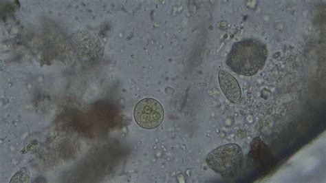 Entamoeba Histolytica Trophozoite In Stool