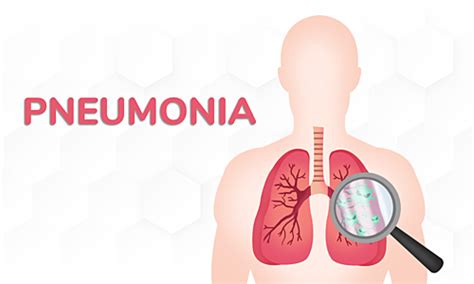 Hermina Hospitals Symptoms Causes And Treatment Of Pneumonia