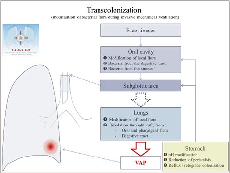 Ventilator Associated Pneumonia