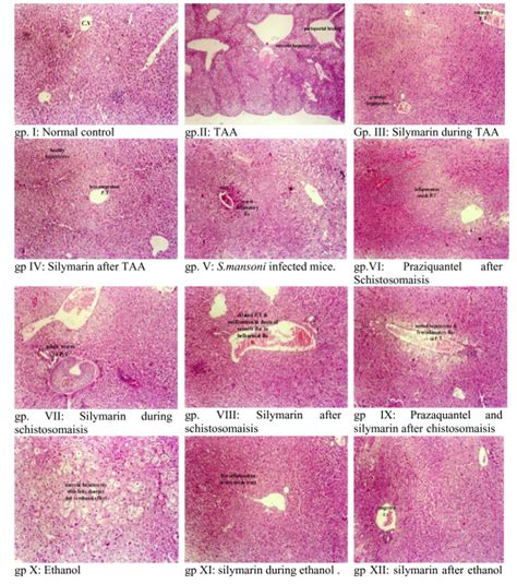 Histological Analysis Of Mice Livers Taa Induced Liver Fibrosis A