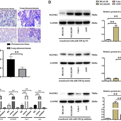 The Relationship Of Mir 338 3p With Map3k2 In Human Specimens A