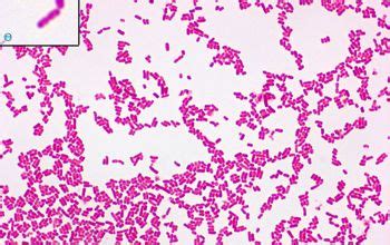 Escherichia coli