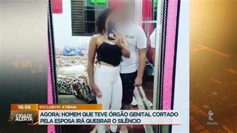 Homem Que Teve Rg O Genital Cortado Fala O Cidade Alerta V Deo