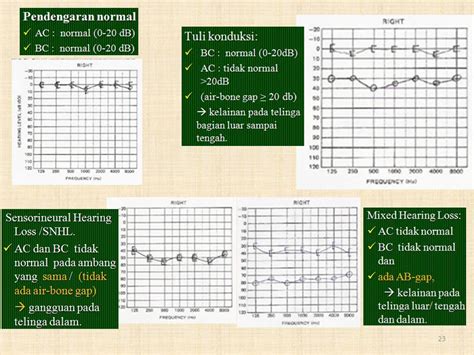 Review Telinga Fakultas Kedokteran Universitas Wijaya Kusuma Surabaya