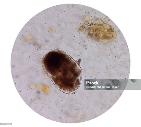 Giardia Lamblia Cysts And Trophozoite Form Muscle Fiber In Stool Examination Under 40x Light