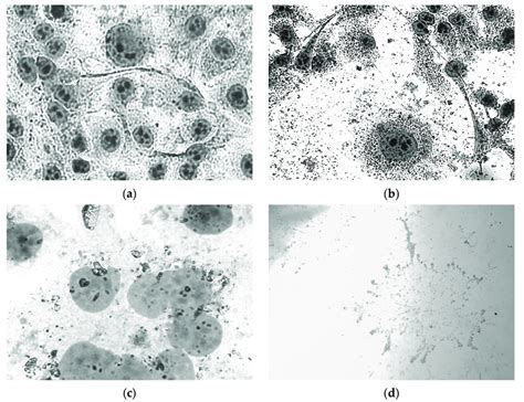 Morphological Changes In Hela Cells In H After Exposure To