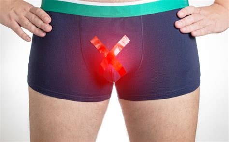 Come Curare Il Varicocele Con La Micro Chirurgia Urologo Napoli