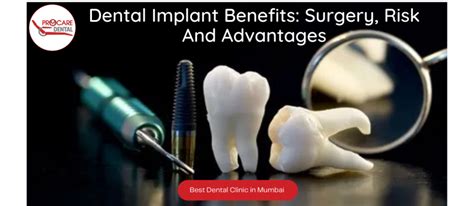 Dental Implant Benefits Surgery Risk Advantages