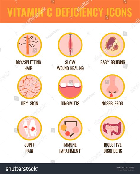 Signs Symptoms Vitamin C Deficiency Icons Vetor Stock Livre De