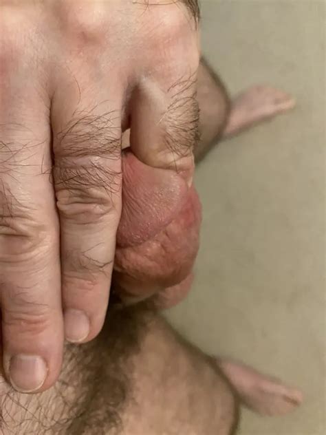 Sounding With My Pinky Finger Deeper 3 Nude Pics XHamster