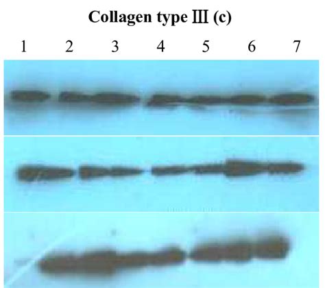 A C Western Blotting Results For The Three Different Groups A